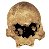 Crâne de Loschbour avant restauration